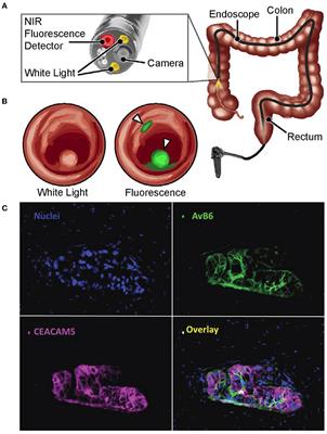 Expanding hyperspectral imaging applications to the clinical scene: non-invasive, label-free approaches for early diagnostics and precision medicine